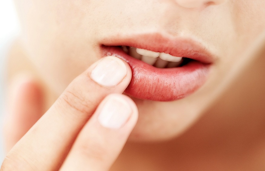 Avoid these 7 things for healthy lips
